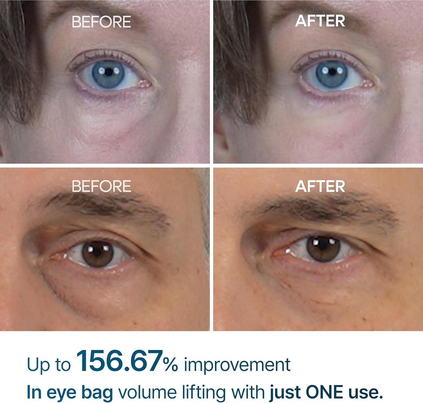 Dr Melaxin - Eyephalt Eye Cream